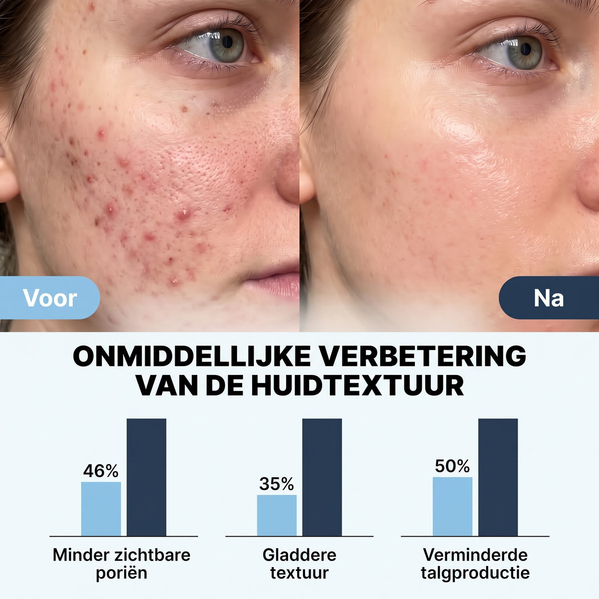 Zero Pore Pads
