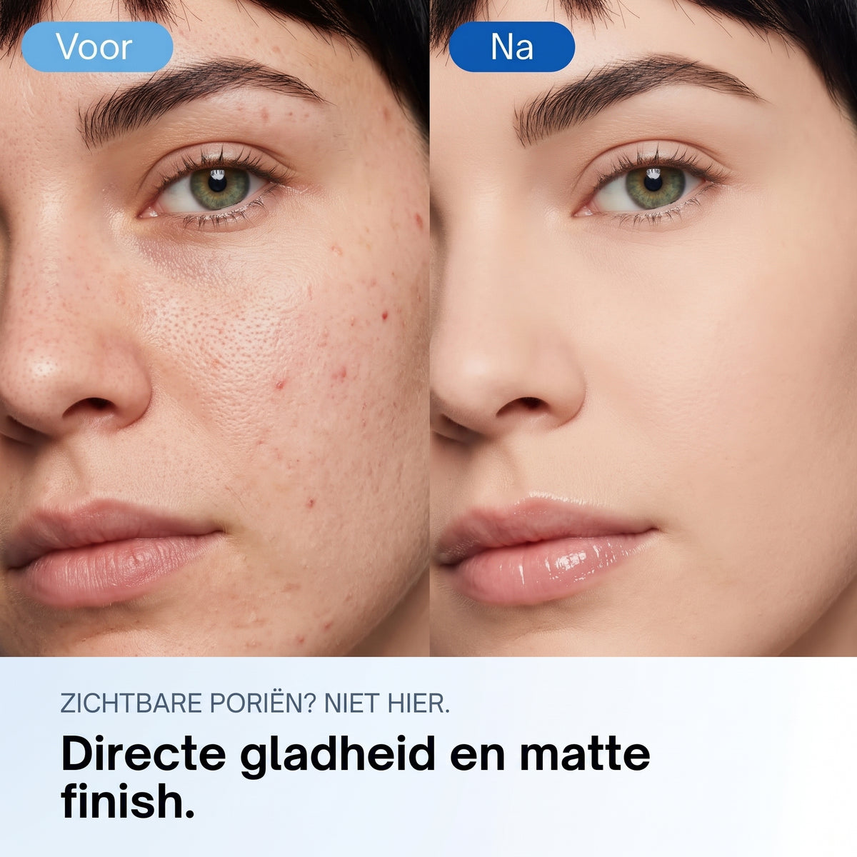 Zero Pore Pads