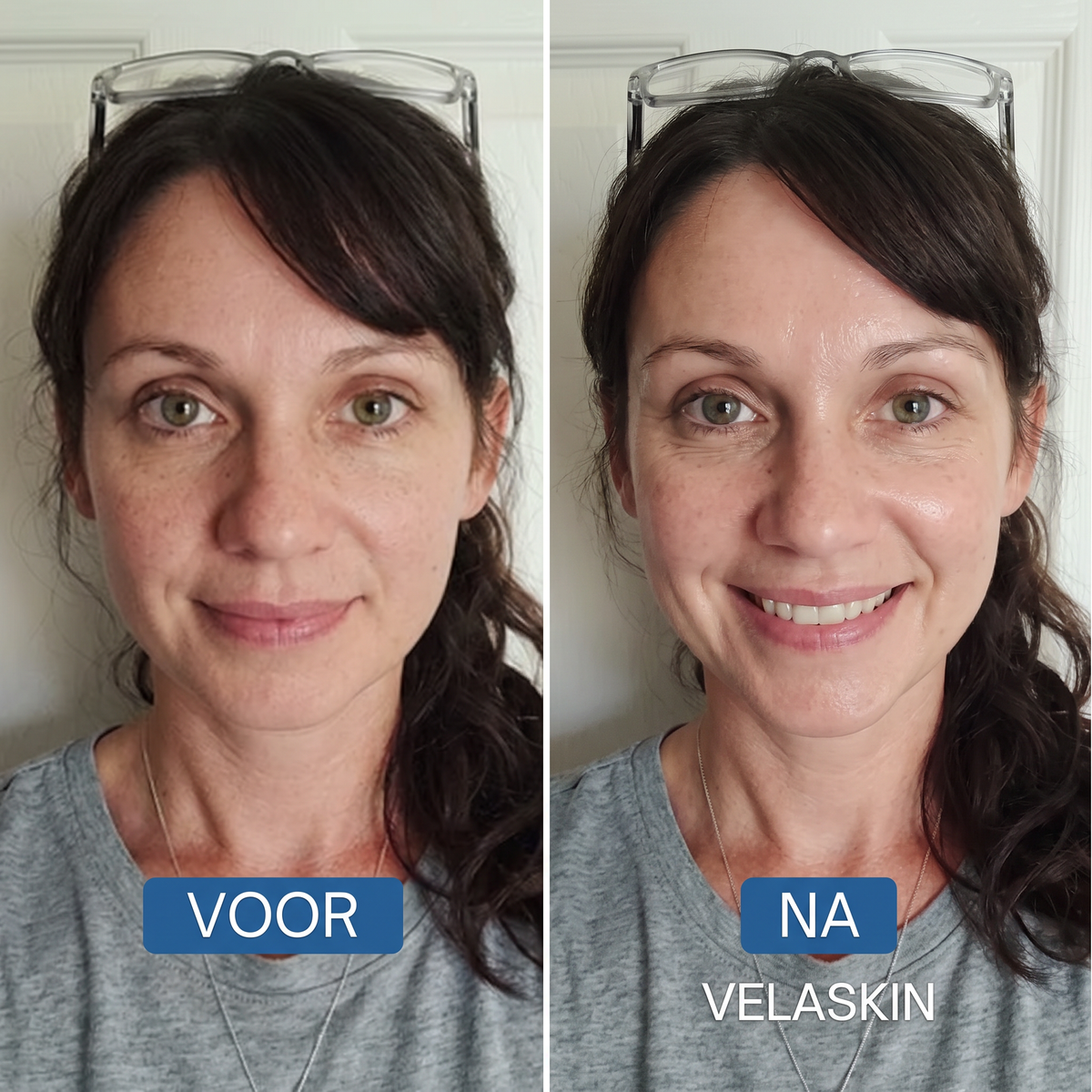 Bio-Collageen Masker