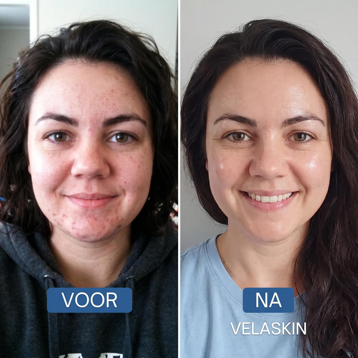 Anti-Aging Set