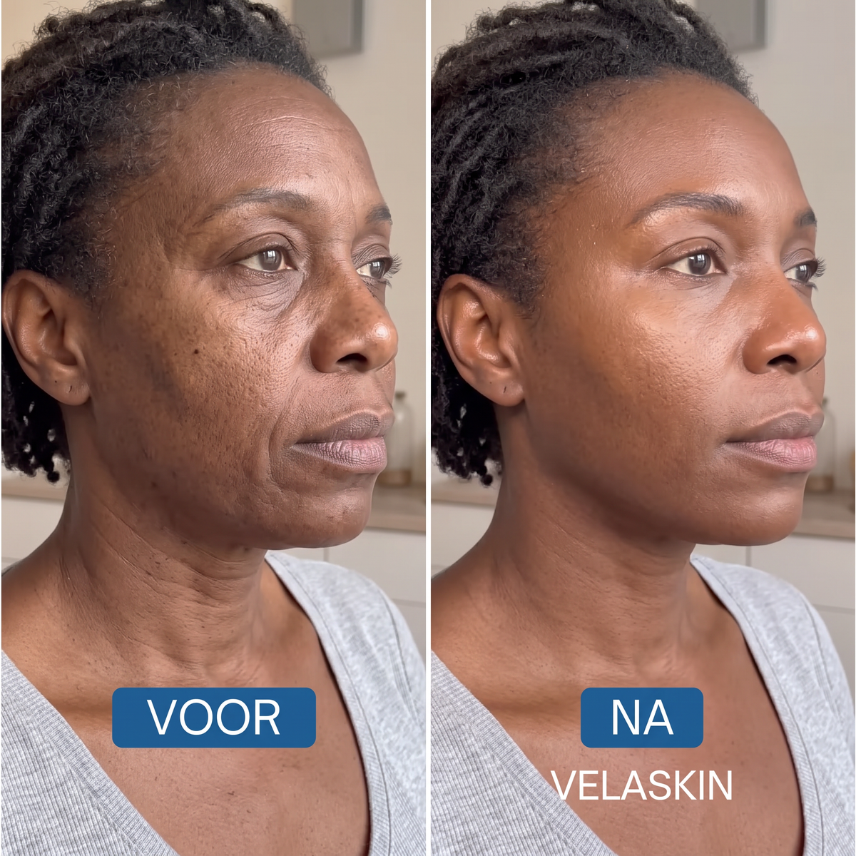 Bio-Collageen Masker